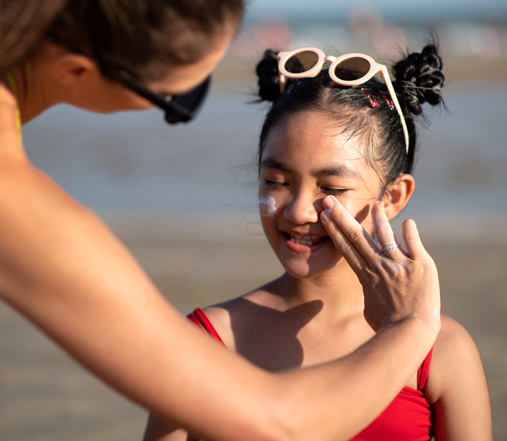 The Real Cost of Sunburns